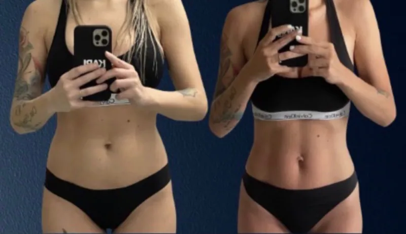 Body sculpting results — Core & Abdomen